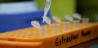 Συνάντηση Κικίλια-Πάιατ: 200.000 τεστ αντισωμάτων έρχονται στην Ελλάδα