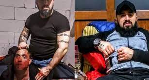 Τούρκος βασάνιζε ομοφυλόφιλους, ανάπηρους, γυναίκες και κωφάλαλους! Συγκλονιστικά VIDEO