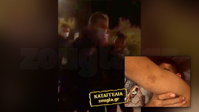 Καταγγελία: Περιστατικό αστυνομικής βίας σε έλεγχο στο Γαλάτσι – “Με χτυπούσαν στο περιπολικό 5 άτομα”-(ΦΩΤΟ)