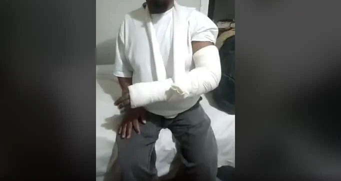 metanastis-amygdaleza3