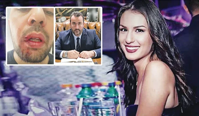 Μήνυση για ξυλοδαρμό! Ο Παπαδόπουλος κατήγγειλε τον εργοδότη της 24χρονης