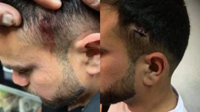 Καταγγελία ΚΕΕΡΦΑ: «Φασίστας πυροβόλησε μουσουλμάνους στα Πατήσια»-(ΦΩΤΟ)