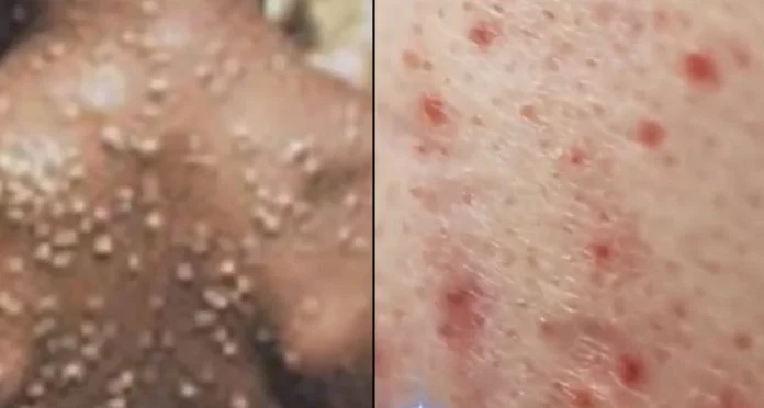 nb_evlogia_pithikon1-696x372