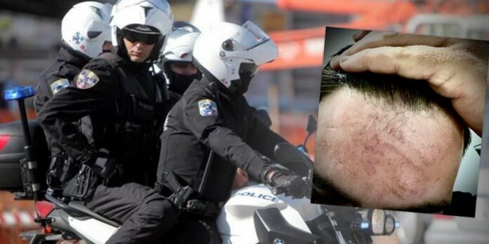 Επιτέθηκαν σε αστυνομικό μέσα σε συνεργείο – Πήγε να φτιάξει την μοτοσικλέτα – ΦΩΤΟ