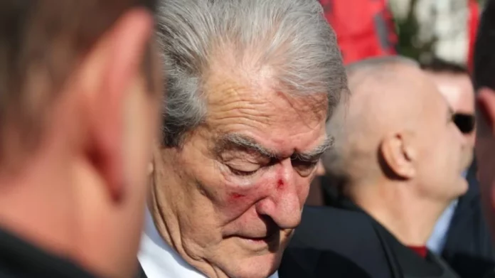 Αλβανία: Γρονθοκόπησαν τον Σαλί Μπερίσα σε αντικυβερνητική διαδήλωση – Βίντεο