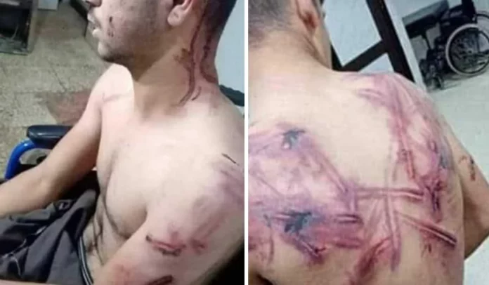 Απάνθρωπος βασανισμός πρόσφυγα από τον τουρκικό στρατό