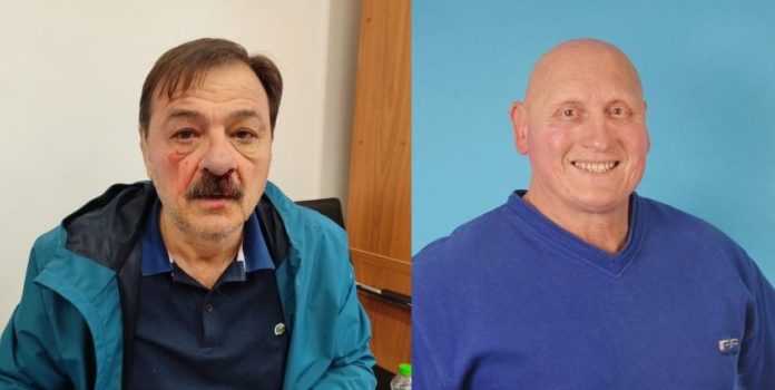 Μασκοφόρος εισήλθε στο ΔΣ της ΔΕΥΑΜΒ και χτύπησε τον Κ. Γαργάλα – Λημνιός: Τον κυνηγήσαμε στις σκάλες, του βγάλαμε τη μάσκα, ήταν ο Β. Ζαχείλας, Πρόεδρος του ΣΥΔΙΣΑ