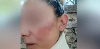 Λέσβος: Συνελήφθη ο πυροσβέστης που χτύπησε τη σύντροφό του και την έστειλε στο νοσοκομείο