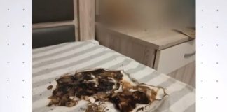 Κινητό εξερράγη κατά τη διάρκεια της φόρτισης – Τι λέει ο 24χρονος που κάηκε στο πρόσωπο