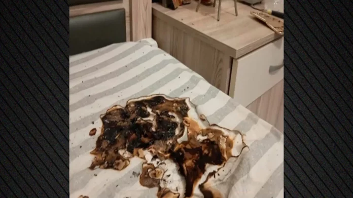 Κινητό τηλέφωνο εξερράγη κατά τη διάρκεια της φόρτισης – Πήρε φωτιά το στρώμα, έπαθε έγκαυμα ο ιδιοκτήτης του