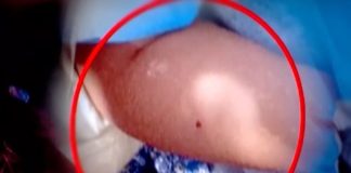 Λάρισα: Διαστάσεις απόλυτης φρίκης – Τι δείχνουν τα σημάδια με μαρκαδόρο στα σώματα των παιδιών