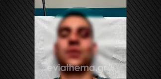 Χαλκίδα: 18χρονος έστειλε στο νοσοκομείο με κάταγμα 19χρονο επειδή έκανε like στη σύντροφό του