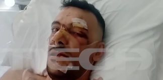 Μυτιλήνη: “Έχει τρύπες σε πνεύμονα, διάφραγμα και του κόπηκαν οι μύες”: Από θαύμα ζει ο 35χρονος που δέχθηκε 18 μαχαιριές σε πανηγύρι