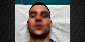 Ήταν σε ημιλιπόθυμη κατάσταση και εκείνος τον χτυπούσε με μανία, λέει ο αδερφός του 19χρονου που ξυλοκοπήθηκε από 18χρονο για ένα like