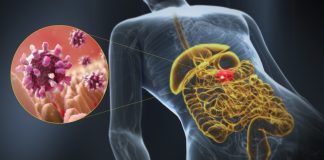 Τζιά: Ανησυχία με έκρηξη κρουσμάτων γαστρεντερίτιδας – Τι λένε οι ειδικοί