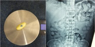 «Ελ. Βενιζέλος»: Συνελήφθη άνδρας που είχε καταπιεί 100 «αυγουλάκια» κοκαΐνης (photos)