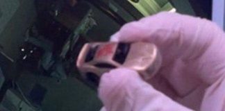 Ρωσία: Αγόρι κατάπιε αυτοκινητάκι – Εφαρμόστηκε ασυνήθιστη ιατρική μέθοδος για την αφαίρεση του παιχνιδιού