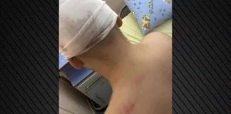 Για απόπειρα ανθρωποκτονίας κατηγορείται ο 18χρονος που συνελήφθη για τον άγριο ξυλοδαρμό 13χρονου στη Θεσσαλονίκη