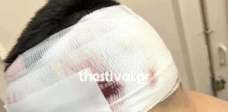 Θεσσαλονίκη: Σε κατ’ οίκον περιορισμό ο 18χρονος που κατηγορείται για τον ξυλοδαρμό του 13χρονου – Διαφώνησαν εισαγγελέας και ανακρίτρια