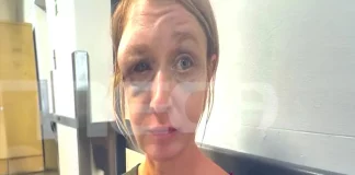 Σοκάρει η εικόνα της 40χρονης που ξυλοκοπήθηκε στο Κορωπί – «Δεν πιστεύω ότι μου επιτέθηκε ο σύντροφός μου, μπορεί οι γείτονες» λέει