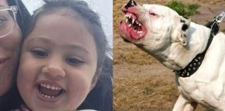 Παρ’ολίγον τραγωδία: Pit bull επιτέθηκε σε 4χρονη – Της «έσκισε» το πρόσωπο – Σκληρές εικόνες