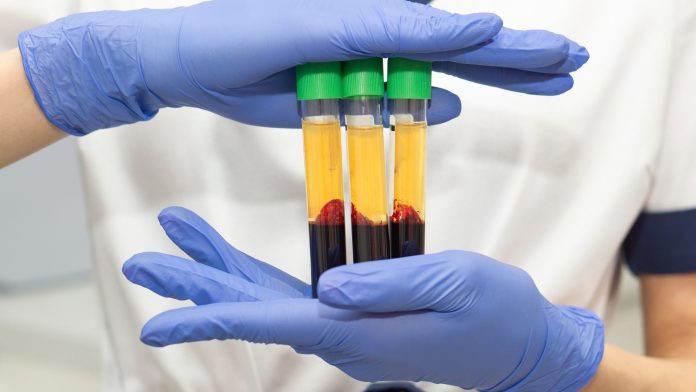 Αντιδράσεις ασθενών για την εμπορευματοποίηση του πλάσματος