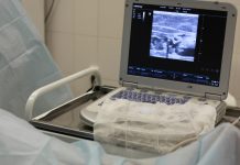 To ΕΣΥ του Γεωργιάδη! Ασθενείς που χρειάζονται άμεσα υπερηχογράφημα δεν βρίσκουν ραντεβού στον ΕΟΠΥΥ