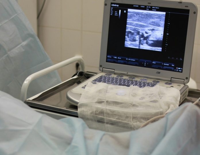 To ΕΣΥ του Γεωργιάδη! Ασθενείς που χρειάζονται άμεσα υπερηχογράφημα δεν βρίσκουν ραντεβού στον ΕΟΠΥΥ