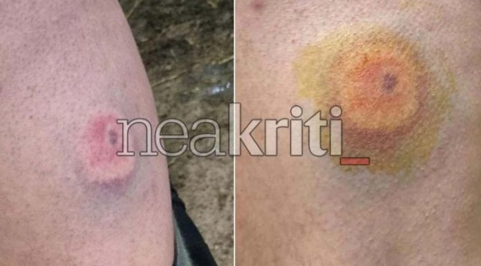 Μπάχαλο στην Κρήτη! – «Έπεσαν σφ@ρες… και τώρα κάνει τον ανήξερο» – (VIDEO)