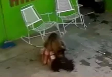 Μεξικό: Άγρια επίθεση σκύλου σε 7χρονο κορίτσι – Χρειάστηκε να της γίνουν 68 ράμματα στο κεφάλι