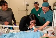 Σιαμαία κοριτσάκια διαχωρίστηκαν μετά από επέμβαση με 22 γιατρούς – Τα κλάματα των γονιών μόλις έμαθαν ότι πέτυχε