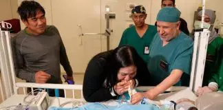 Σιαμαία κοριτσάκια διαχωρίστηκαν μετά από επέμβαση με 22 γιατρούς – Τα κλάματα των γονιών μόλις έμαθαν ότι πέτυχε