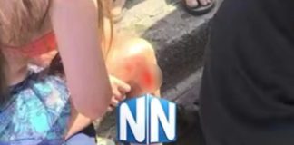 Ναύπακτος: 12χρονο κοριτσάκι σφήνωσε σε φρεάτιο και τραυματίστηκε – Την απεγκλώβισαν άνδρες της Πυροσβεστικής