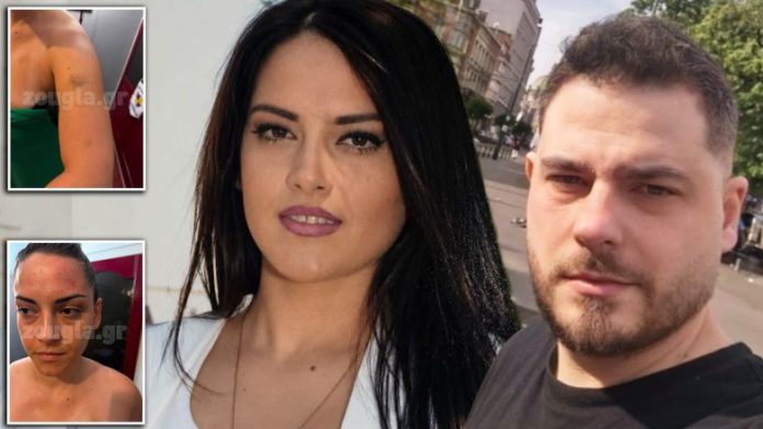 Συνεργάτης της Λατινοπούλου ξυλοκόπησε και έστειλε στο νοσοκομείο δημοσιογράφο της «Ζούγκλας»