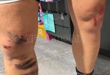 Κρυονέρι: Άγρια επίθεση λύκου σε κάτοικο – «Πάλευα για τη ζωή μου 8 λεπτά» Κρυονέρι: Άγρια επίθεση λύκου σε κάτοικο - «Πάλευα για τη ζωή μου 8 λεπτά»