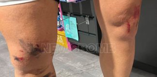 Κρυονέρι: Άγρια επίθεση λύκου σε κάτοικο – «Πάλευα για τη ζωή μου 8 λεπτά» Κρυονέρι: Άγρια επίθεση λύκου σε κάτοικο - «Πάλευα για τη ζωή μου 8 λεπτά»