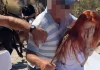 Σαντορίνη: Τραμπούκοι αγωγιάτες γαϊδουριών ξυλοκόπησαν ακτιβίστριες
