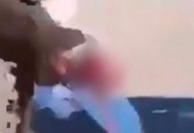Γαλλία: 15χρονος ακρωτηριάστηκε στο χέρι από χειροβομβίδα κρότου-λάμψης στη διάρκεια διαδήλωσης-(VIDEO)