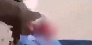 Γαλλία: 15χρονος ακρωτηριάστηκε στο χέρι από χειροβομβίδα κρότου-λάμψης στη διάρκεια διαδήλωσης-(VIDEO) Γαλλία: 15χρονος ακρωτηριάστηκε στο χέρι από χειροβομβίδα κρότου-λάμψης στη διάρκεια διαδήλωσης-(VIDEO)
