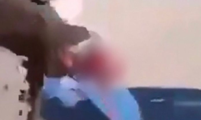 Γαλλία: 15χρονος ακρωτηριάστηκε στο χέρι από χειροβομβίδα κρότου-λάμψης στη διάρκεια διαδήλωσης-(VIDEO)